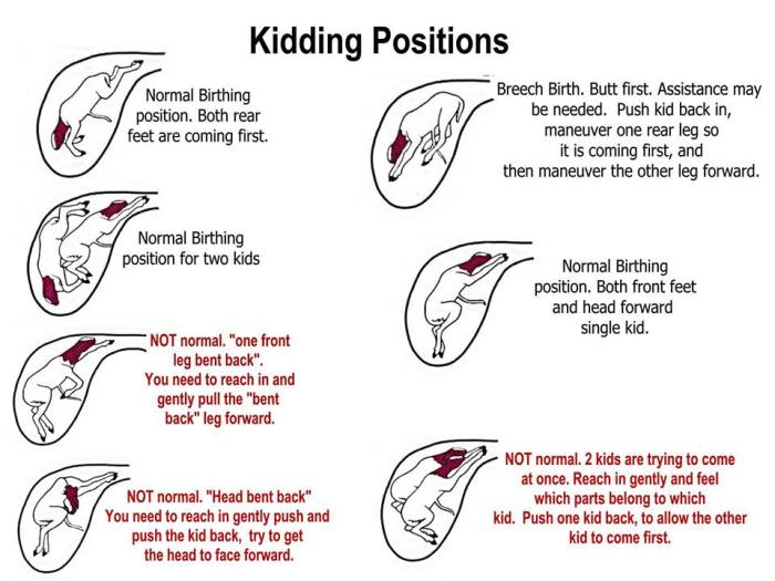 Mig 1900 contractions minutes suzanne apart seconds strong very last homeworklib